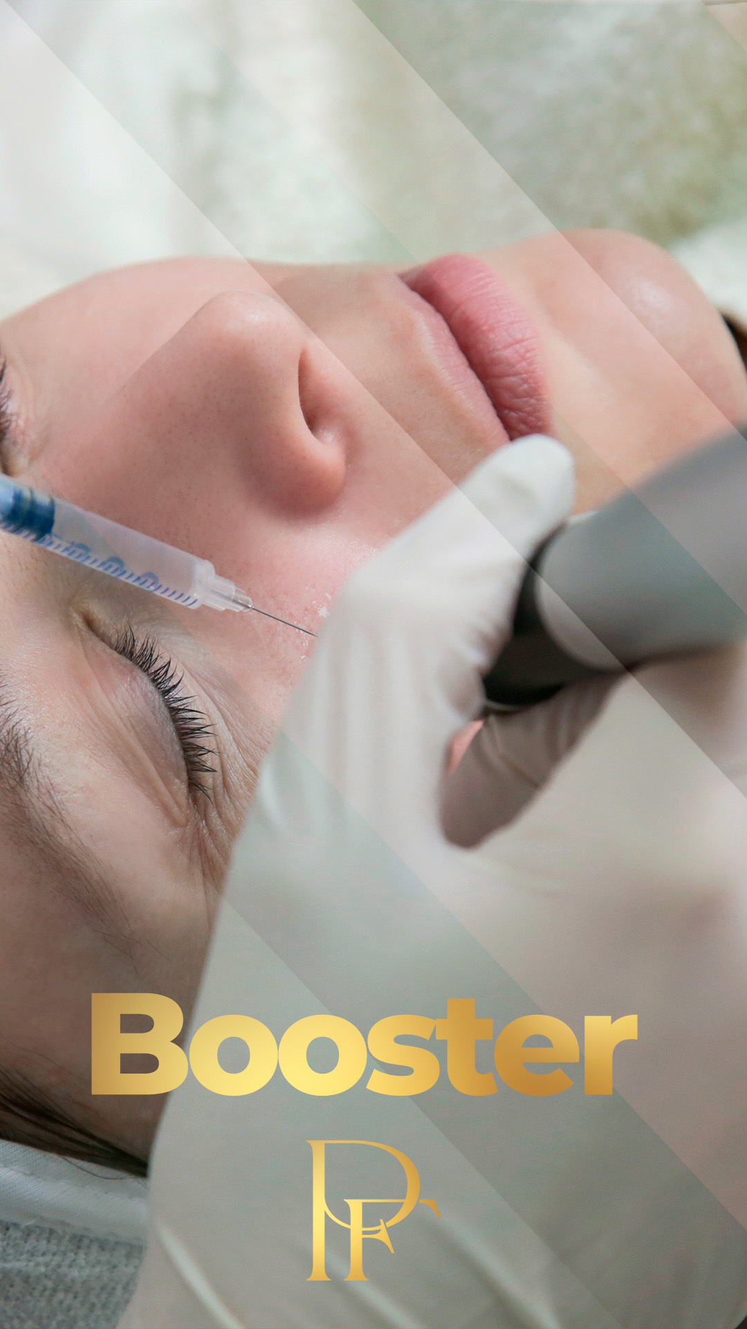 Curso de Microagulhamento Skinbooster