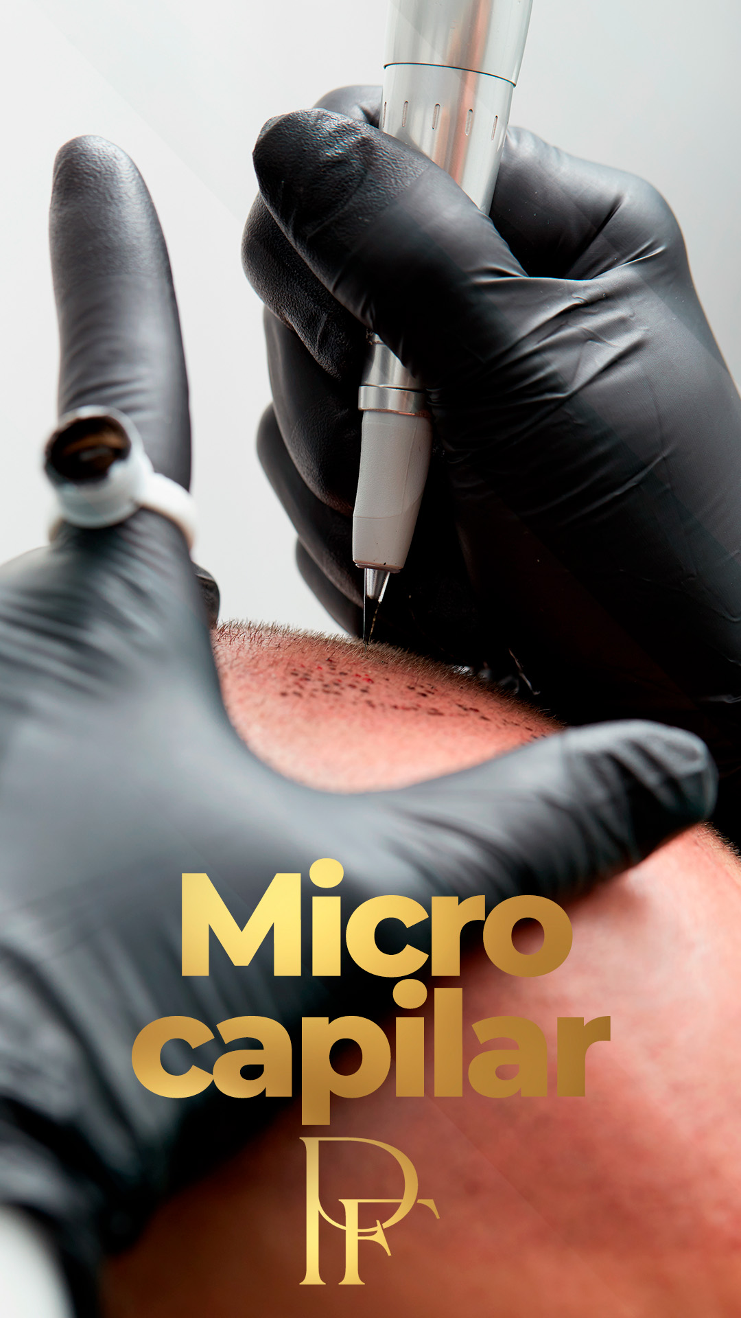 Curso de Micropigmentação Capilar